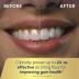 Waterpik Aquarius Water Flosser Professional For Teeth