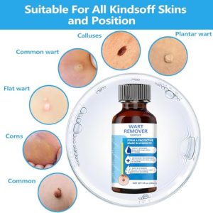 Fvtcnbu Liquid Wart & Skin Tag Remover with Salicylic Acid