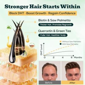 Saw Palmetto Gummies: Prostate, Hair & Urinary Health