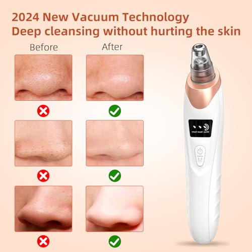 Pore Vacuum Blackhead Remover - USB Rechargeable Face Cleanser - Image 3