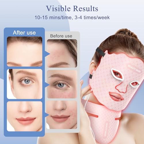 Fiogeo 7-Color LED Light Therapy Mask for Face & Neck - Image 4