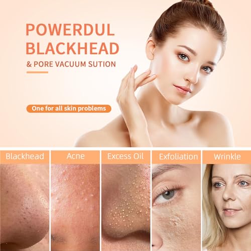 Pore Vacuum Blackhead Remover - USB Rechargeable Face Cleanser - Image 5