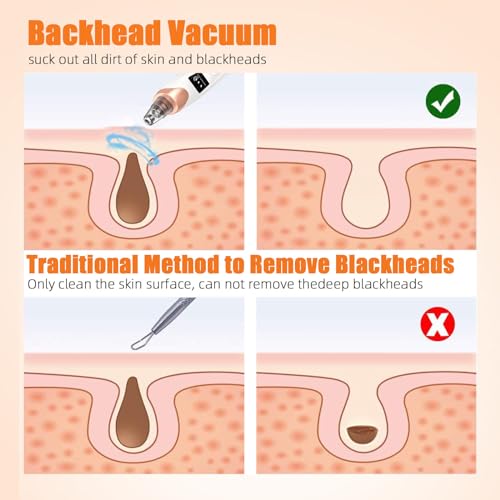 Pore Vacuum Blackhead Remover - USB Rechargeable Face Cleanser - Image 6