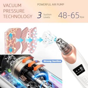 Pore Vacuum Blackhead Remover – USB Rechargeable Face Cleanser